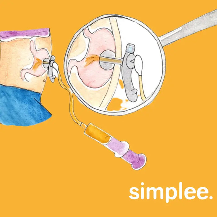 Facts-zur-Sonde Simply Real Nutrition GmbH